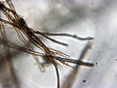 Schenella microspora