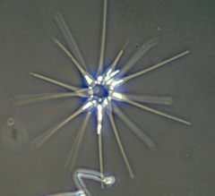 Asterionellopsis glacialis