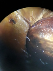 Rhizotrogus aestivus