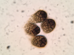 Berkleasmium corticola