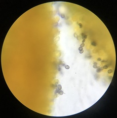 Melanoleuca angelesiana