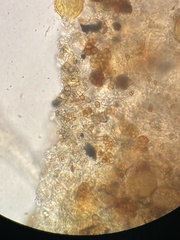 Coccomyces triangularis
