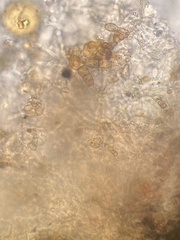 Coccomyces triangularis