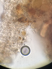 Coccomyces triangularis
