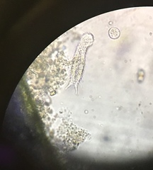 Gastrotricha