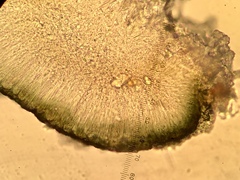 Strangospora moriformis