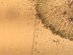 Strangospora moriformis