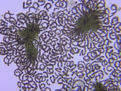 Dolichospermum lemmermannii