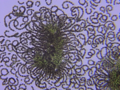 Dolichospermum lemmermannii