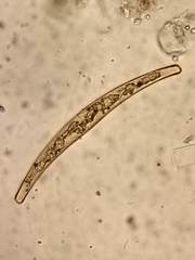 Closterium costatum