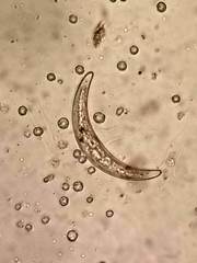 Closterium leibleinii