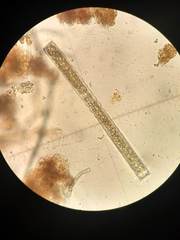 Pleurotaenium coronatum