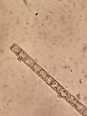 Aulacoseira muzzanensis