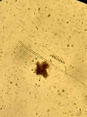 Closterium acutum
