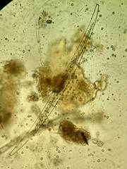 Closterium ralfsii