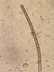 Komvophoron constrictum