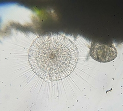 Actinosphaerium eichhornii