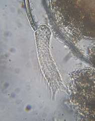 Chaetonotida