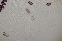 Ascobolus sacchariferus