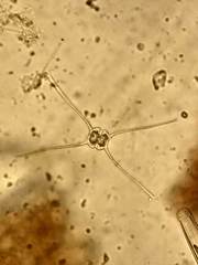 Staurastrum columbetoides