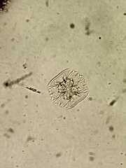 Micrasterias abrupta