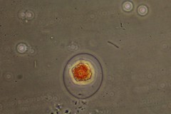 Haematococcus