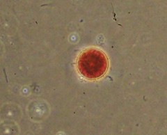 Haematococcus