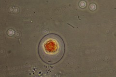 Haematococcus