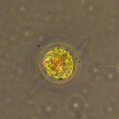 Haematococcus