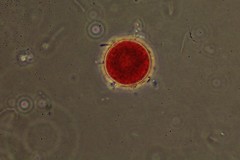Haematococcus