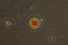 Haematococcus