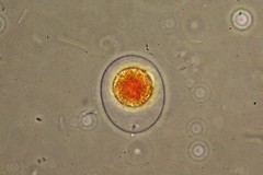 Haematococcus
