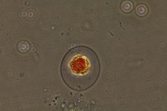 Haematococcus