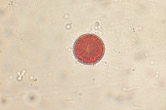 Haematococcus
