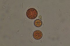 Haematococcus