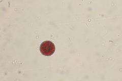 Haematococcus
