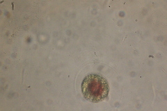 Haematococcus