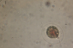 Haematococcus