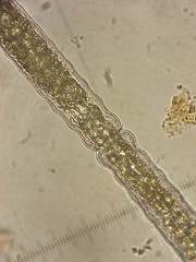 Pleurotaenium coronatum