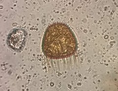 Trachelomonas armata