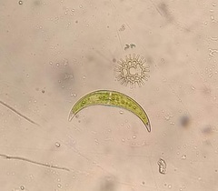 Closterium moniliferum