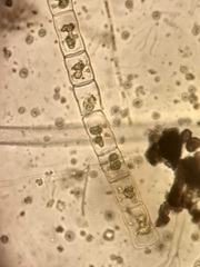 Hyalotheca