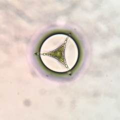 Staurastrum johnsonii