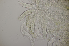 Venturia rumicis