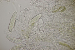 Venturia rumicis