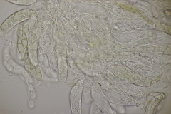 Venturia rumicis