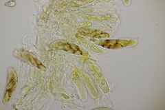 Venturia rumicis