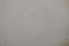 Pyrenopeziza petiolaris