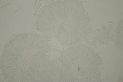 Pyrenopeziza petiolaris