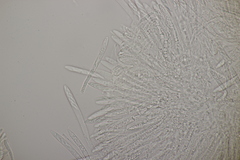 Pyrenopeziza petiolaris
